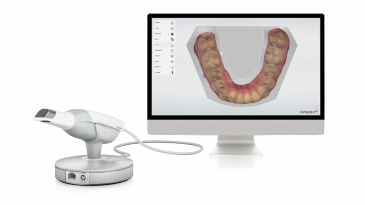 Scanner intraorale, 5 aspetti da valutare prima dell’acquisto